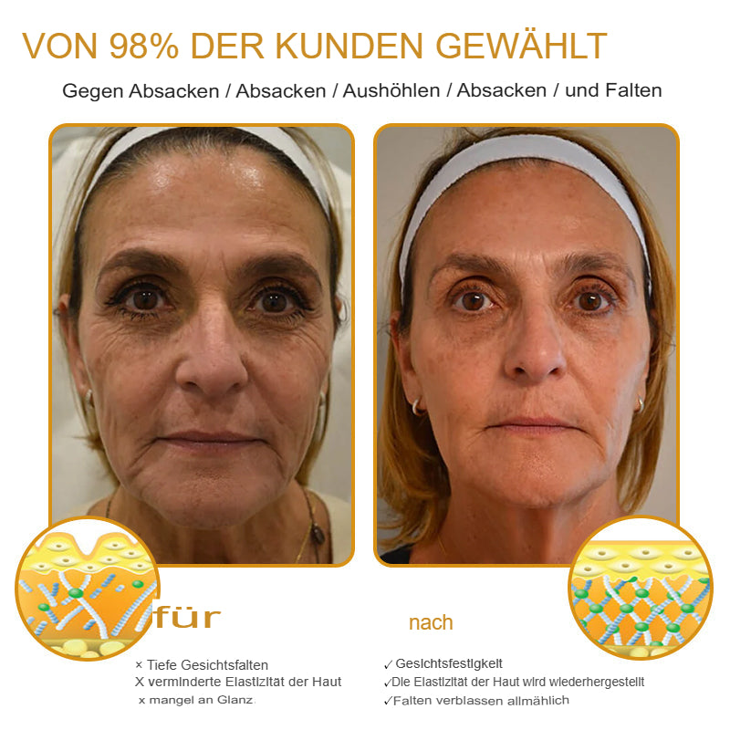 Anti-Wrinkle™ | Botox-Faltenentfernungscreme