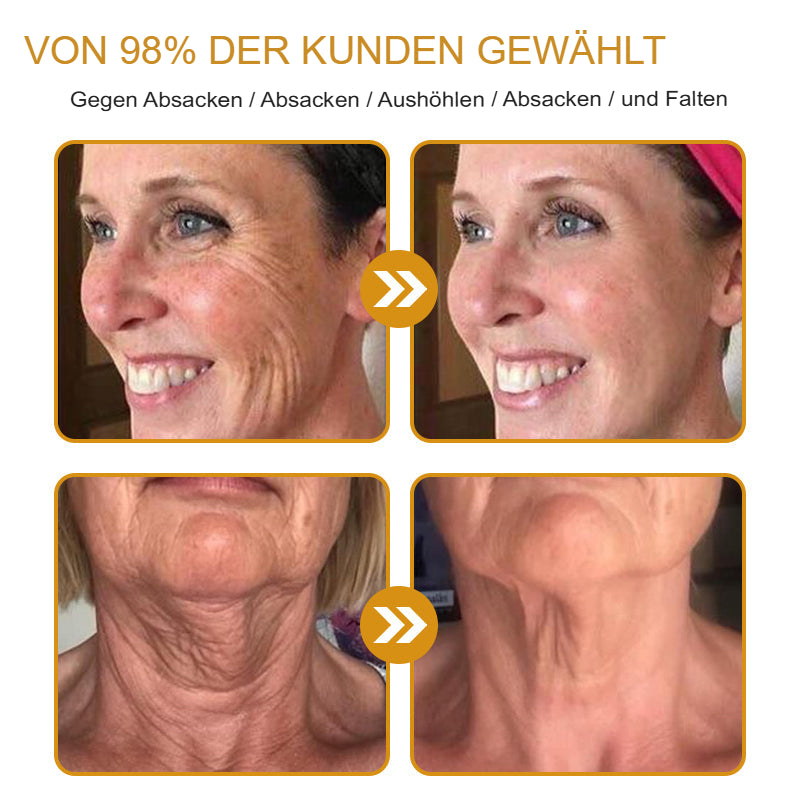 Anti-Wrinkle™ | Botox-Faltenentfernungscreme